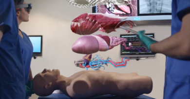Simulación con gafas virtuales en la medicina