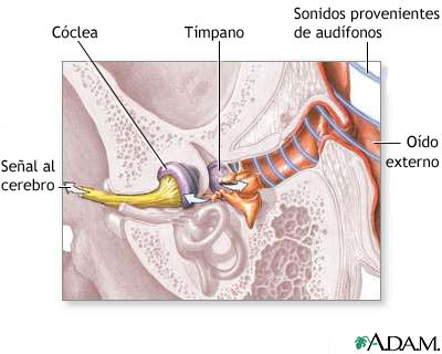 oído interno recibiendo señales que van directamente al cerebro  .