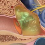 Los efectos de las ondas acústicas en el oído: Un delicado equilibrio entré la física y la biología Efectos de las ondas acústicas.